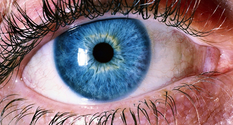 Retinal Detachment: Are You at Risk?