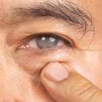 cataract adult pediatric eyecare local eye doctor near you.jpg